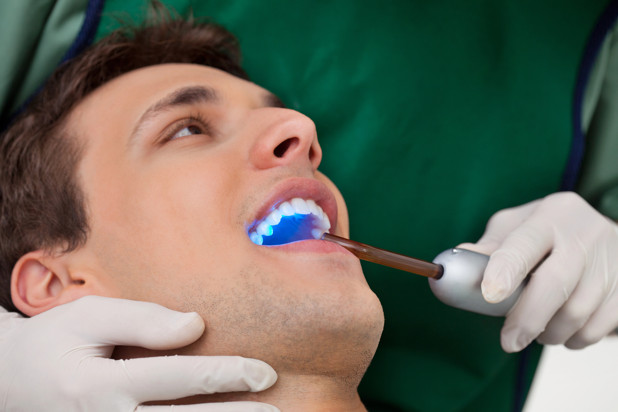 Patient receiving dental bonding treatment with UV curing light