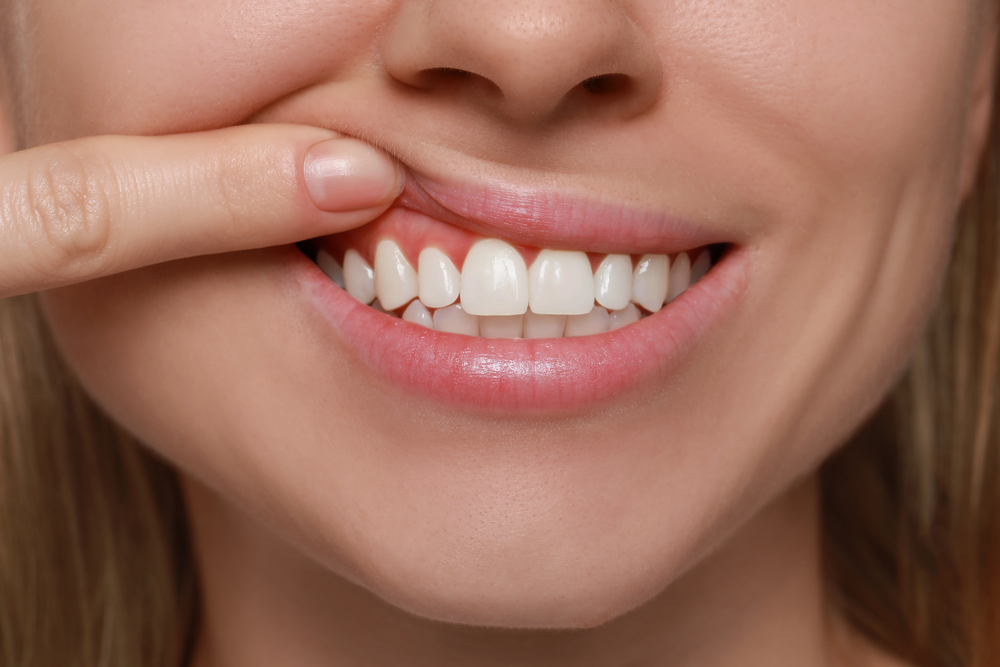 Gum disease treatment
