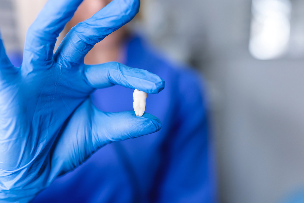 Tooth extraction procedure