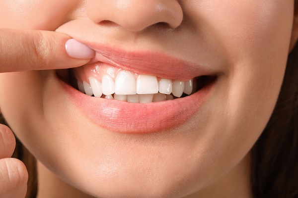 Choose The Right Dentist For Gum Disease Treatment